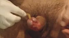 চালান Foley catheter ch 20 - intromission and toy.avi
